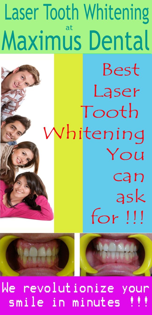 teeth_whitening_banner